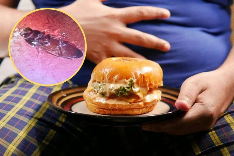 पाचनमा समस्या भएर अस्पताल पुगेका युवकको आन्द्रामा जिउँदो साङ्लो